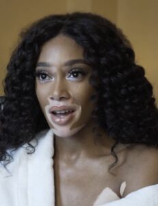 Winnie Harlow: Supermodel, Aktivistin und ihre Geschichte - FASHION