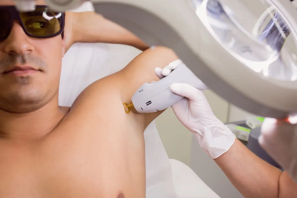 Mann bei einer professionellen Laser-Haarentfernung an der Achsel in einem Behandlungsraum